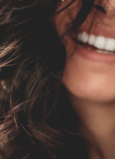 Smile transformation 4