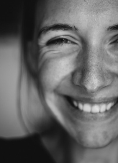 Smile transformation 6