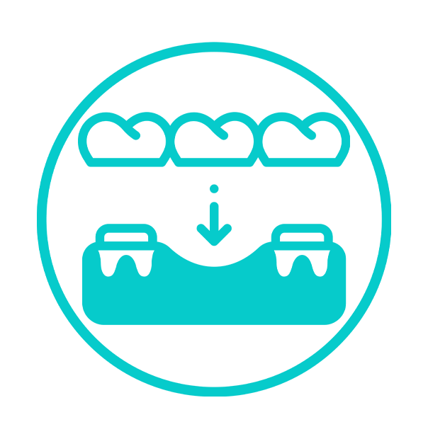 dental implant icon image
