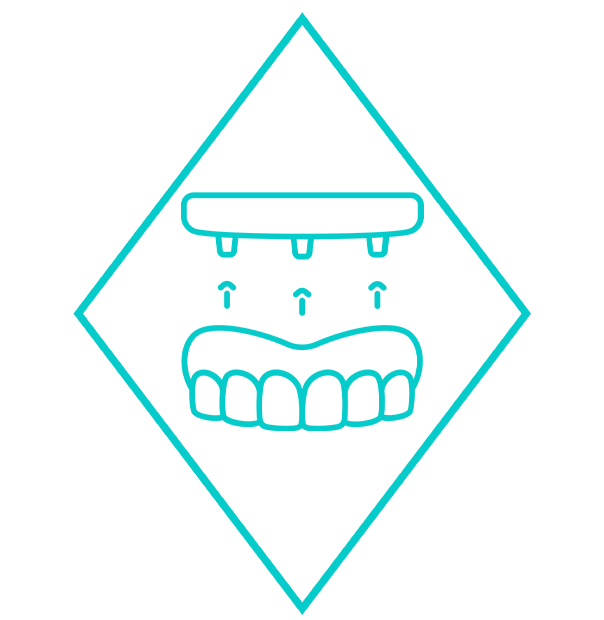 dental implant icon image